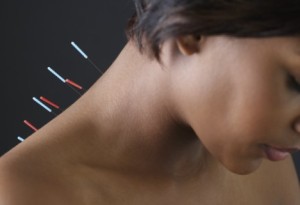 Acupuncture for frozen shoulder