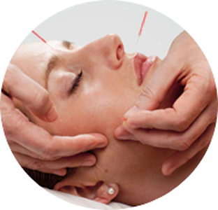 Acupuncture for neurological diseases and disorders