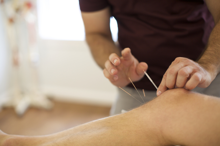 Acupuncture treatment for Sports Injuries 