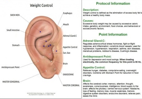 ACUPUNCTURE FOR WEIGHT LOSS