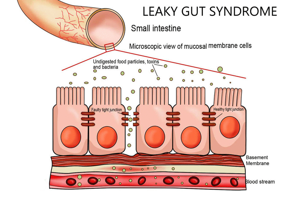 The Gut