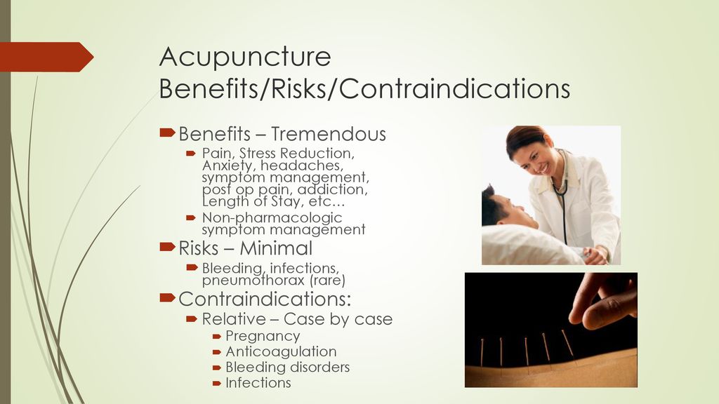 Acupuncture for headaches