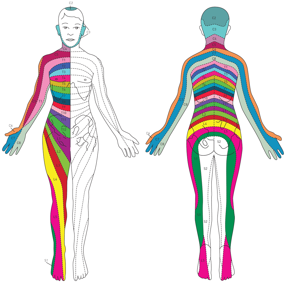 Back pain Radicular lower back pain