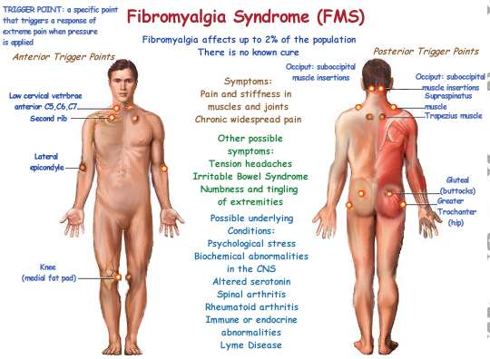 Fibromyalgia Syndrome