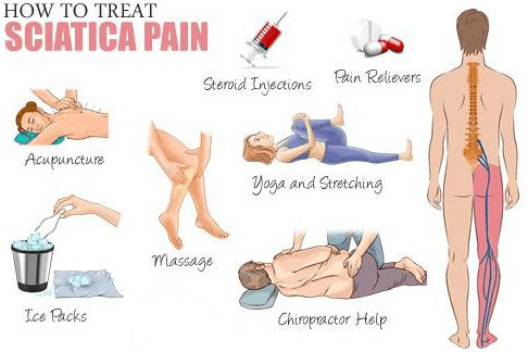 Sciatica Treatment