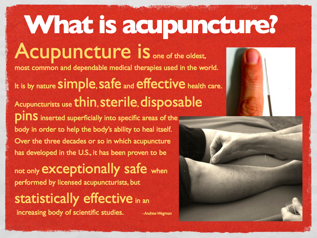 What is Acupuncture
