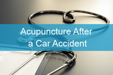 Acupuncture for injuries