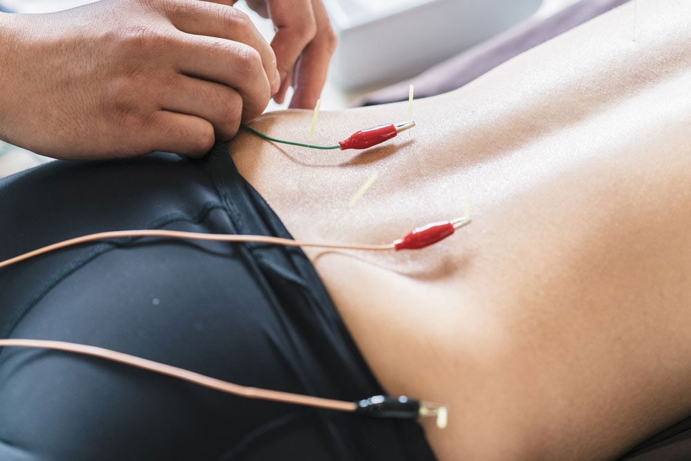 Acupuncture after car accident