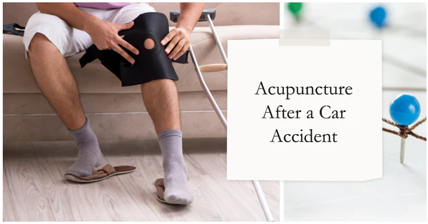 Acupuncture after car accident