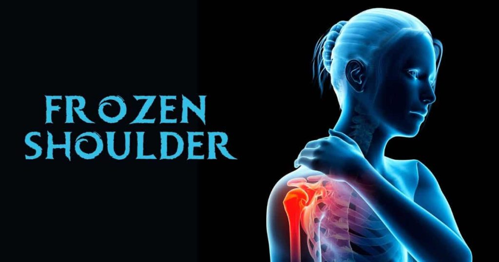 Frozen shoulder