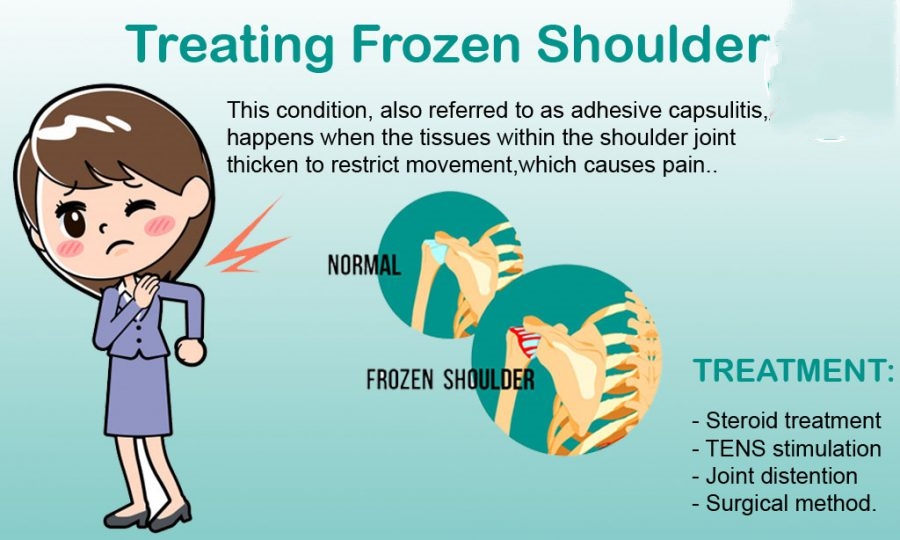 Frozen shoulder treatment