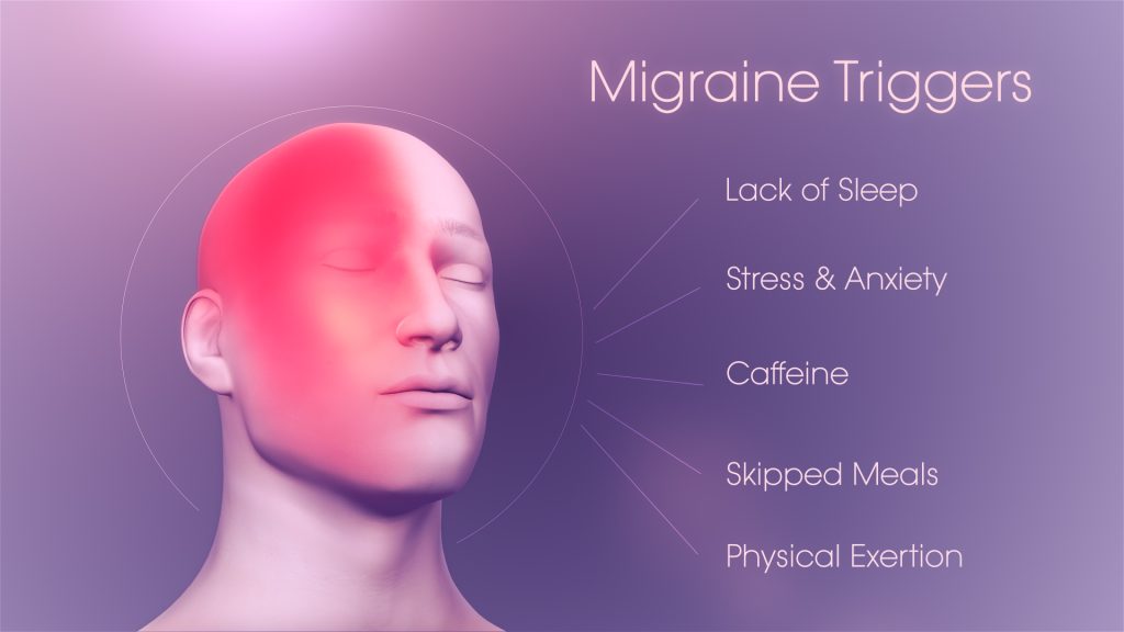 Migraine triggers
