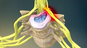 Neck pain causes