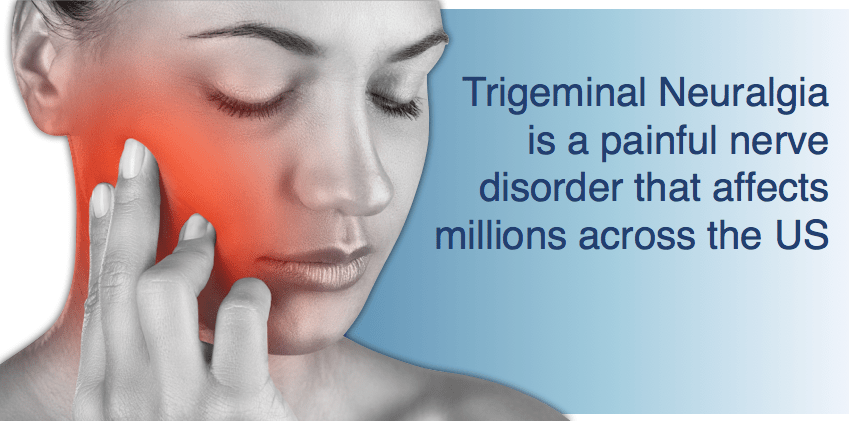 Trigeminal Neuralgia