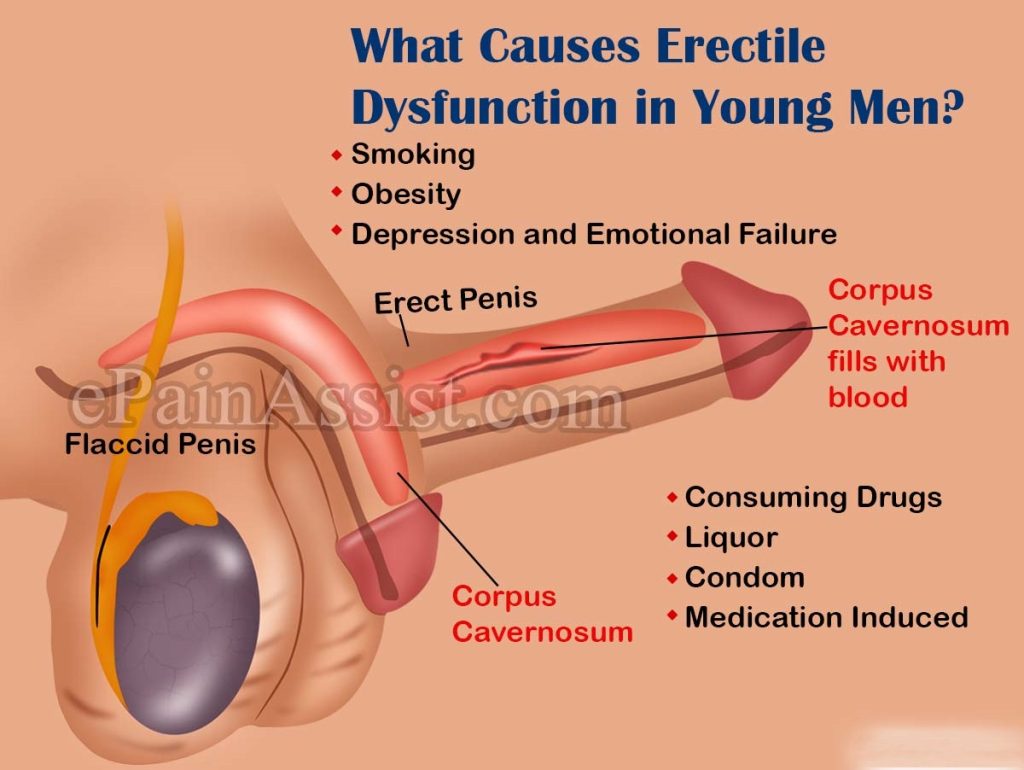 Causes of Erectile dysfunction 