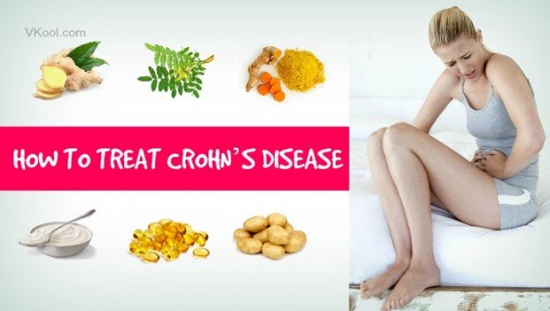 Crohn's disease natural treatments