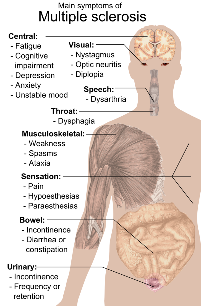 MS - symptoms