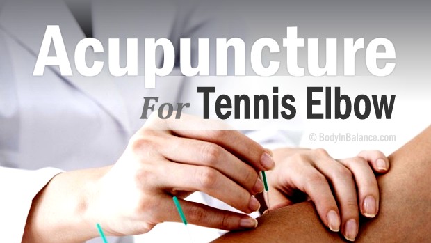 Acupuncture