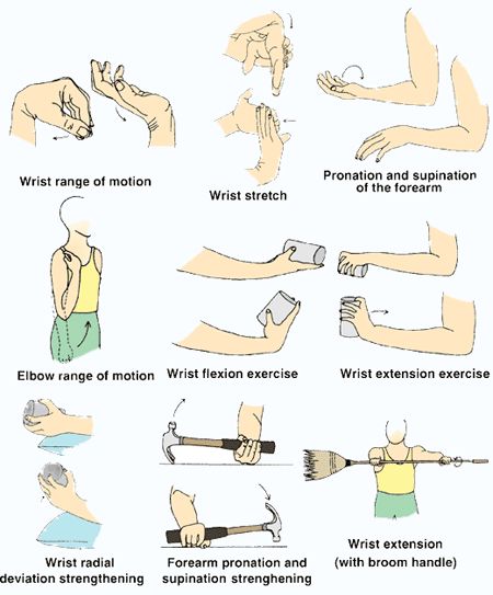 Tennis Elbow exercises