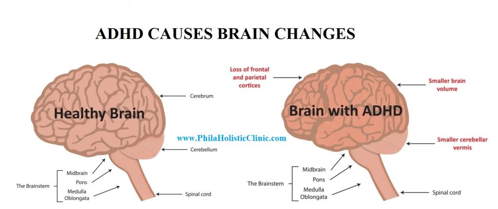 Adhd Mechanism