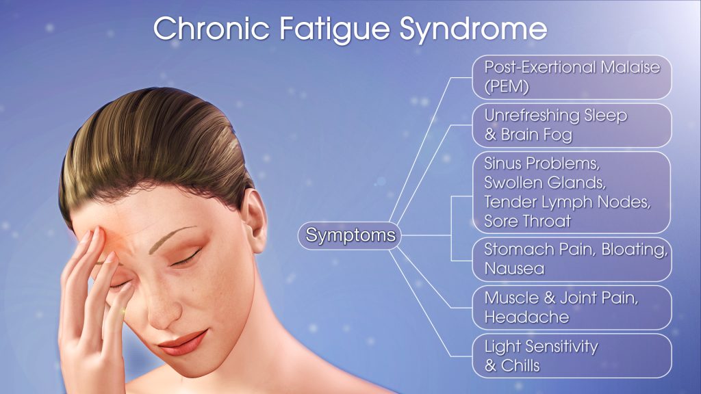 Causes-Of Chronic Fatigue Syndrome