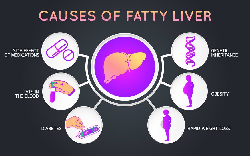 causes