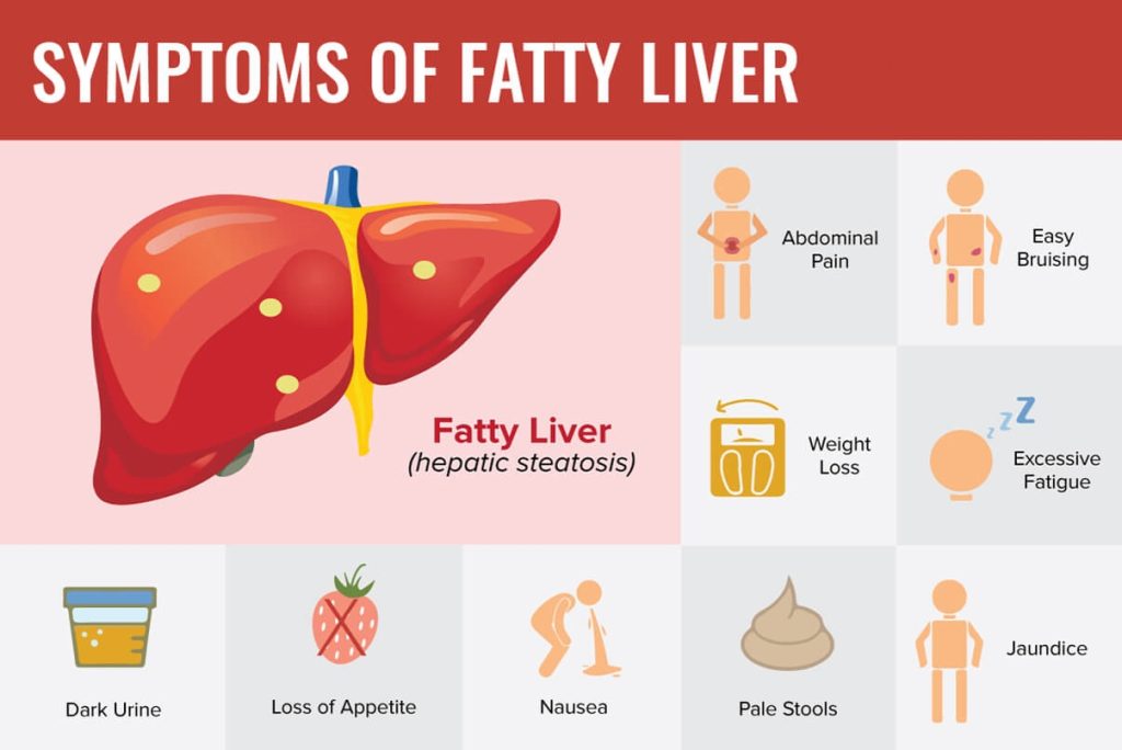 Fatty liver symptoms