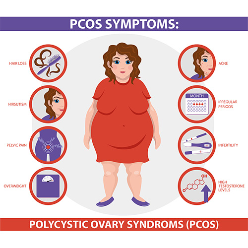 Symptoms of PCOS