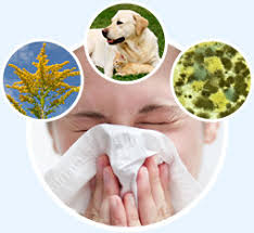 Treatment for allergies