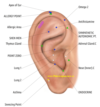 ear acupuncture an effective treatment for allergies