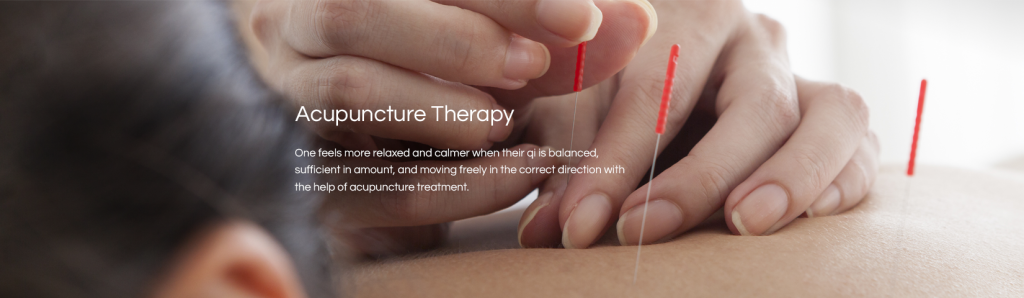 obsessive compulsive disorder Acupuncture
