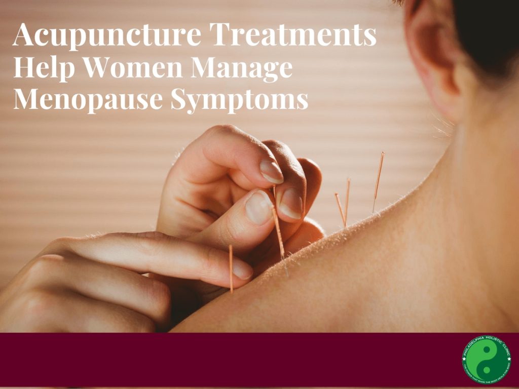 acupunctur 