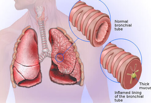 Symptoms, causes, signs