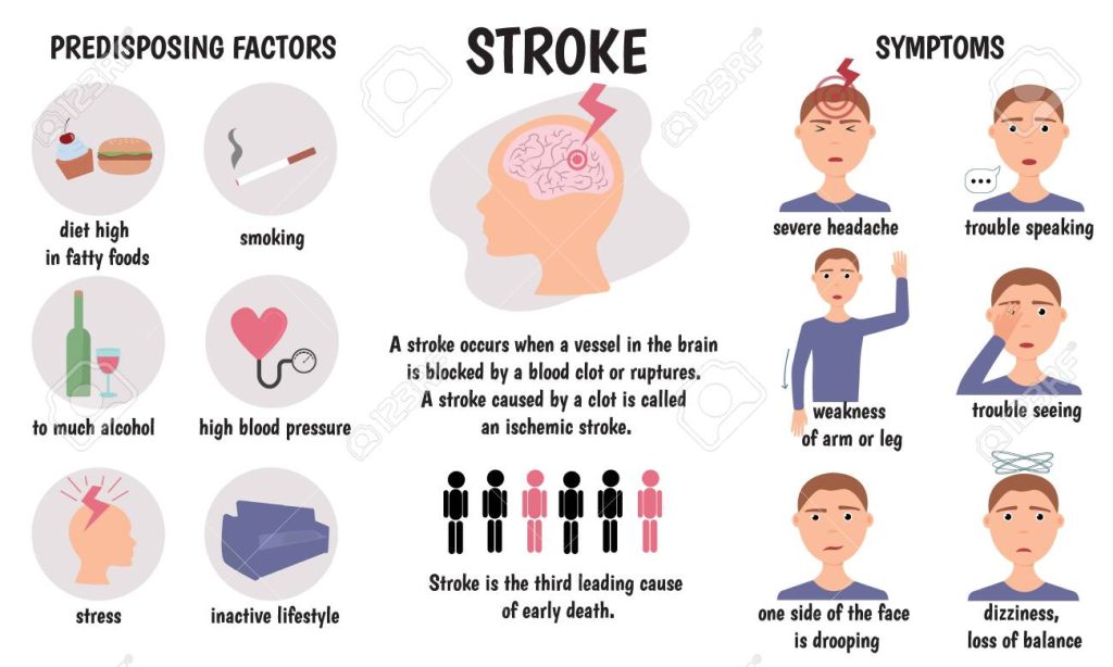 Facts about stroke
