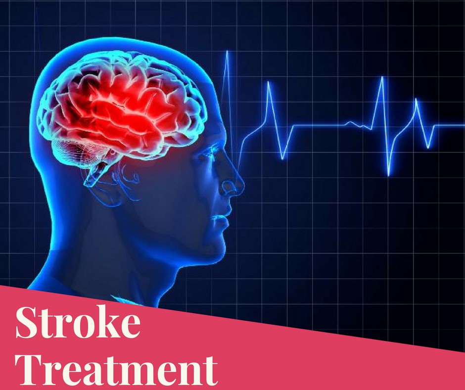 Stroke Treatment