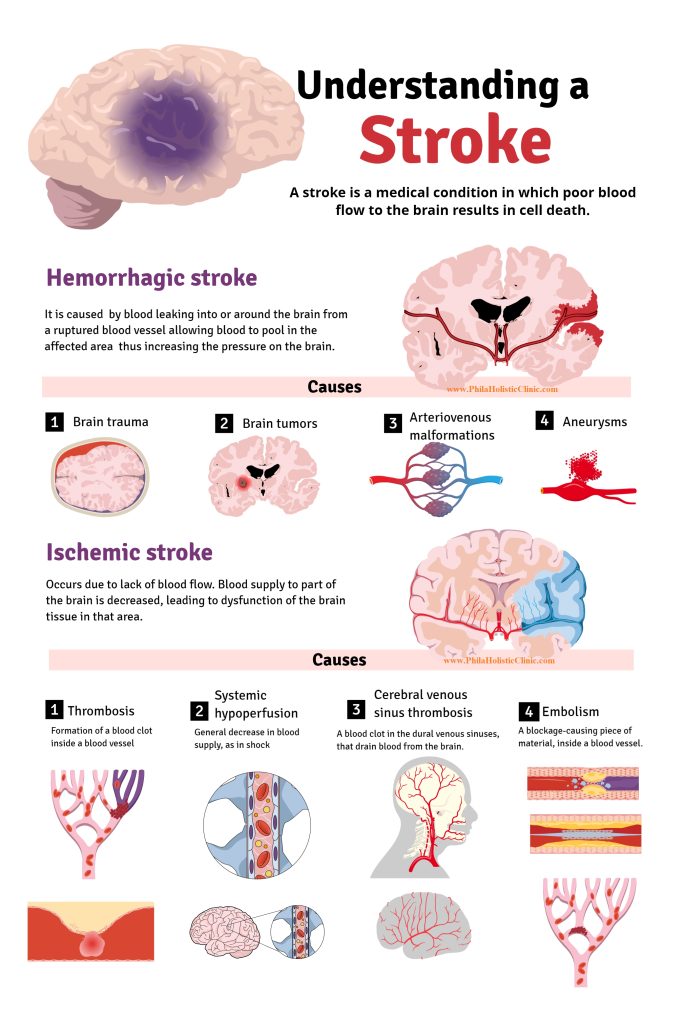 causes