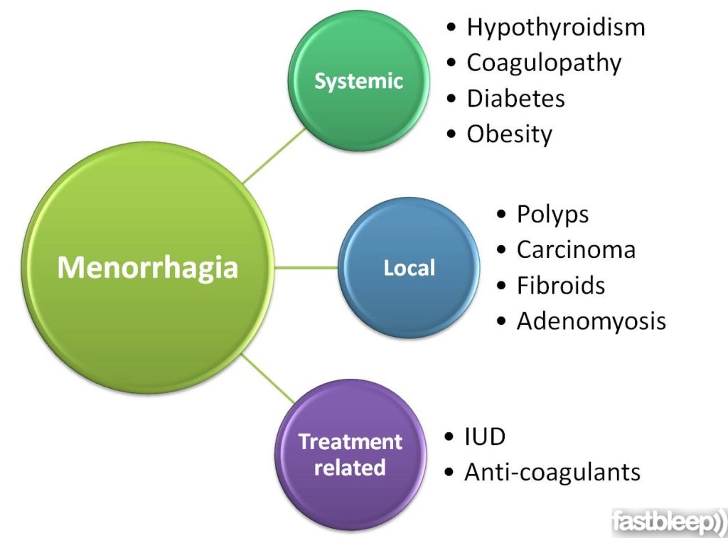 Causes of heavy periods