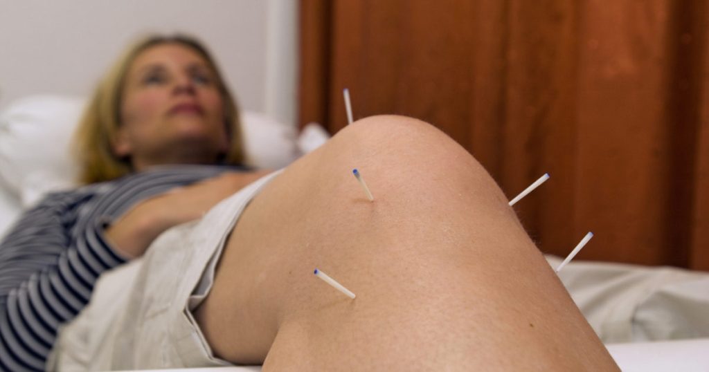 Acupuncture for knee pain