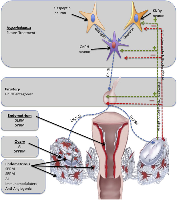 Treatment for endometriosis