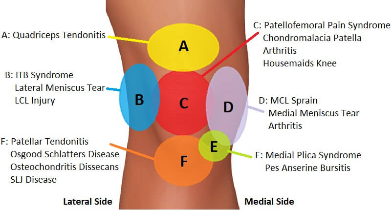 What causes pain