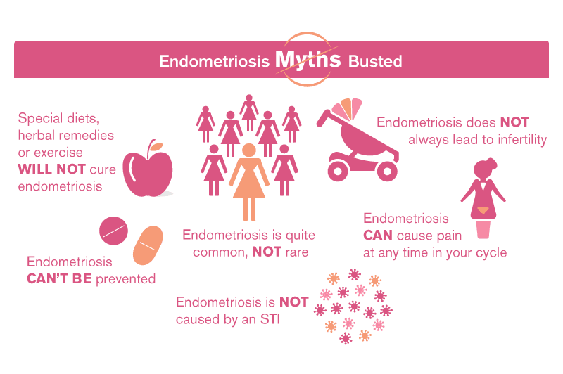 Endometriosis: Myths and True