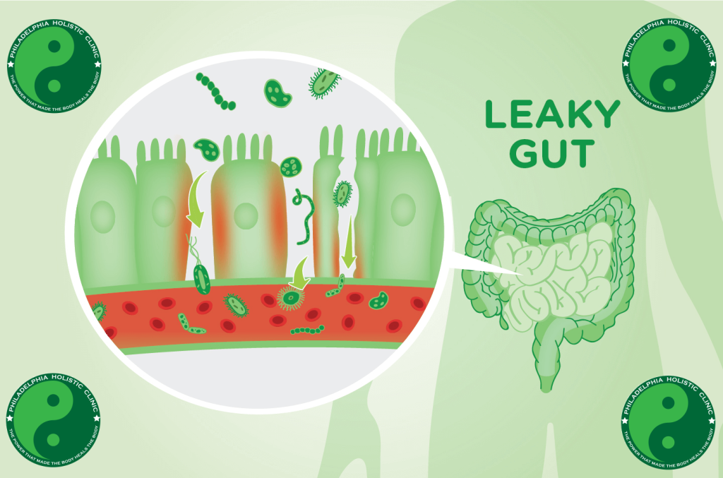 Leaky gut