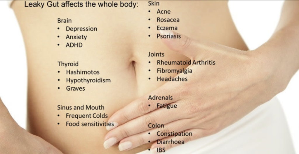 Symptoms