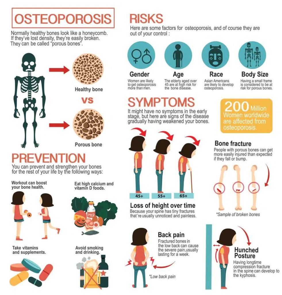 Osteoporosis