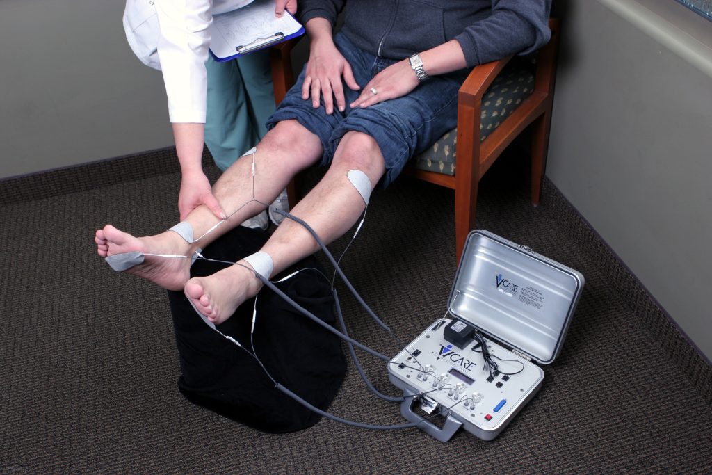 Peripheral neuropathy nerve stimulation