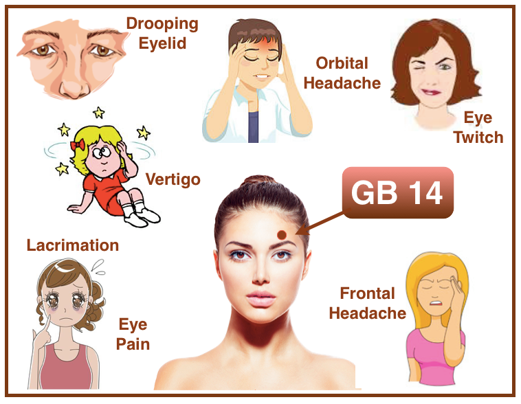 Acupucntre points for ptosis