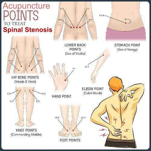 Acupuncture points