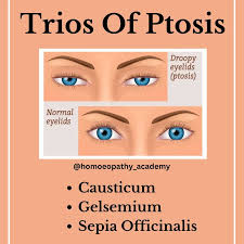 Homeopathy for ptosis