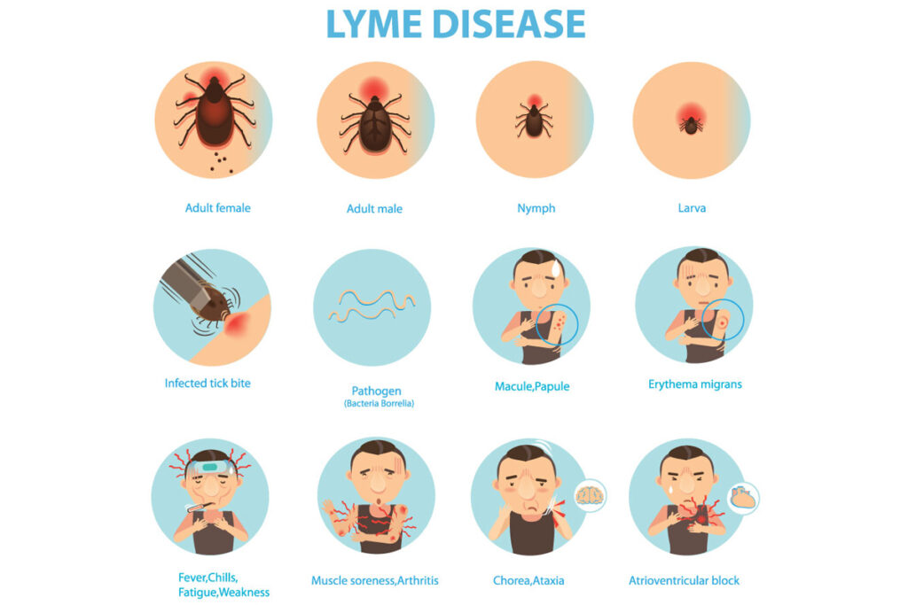 Treatment for Lyme disease
